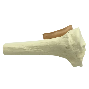 The Adult Proximal Tibia Training Bone is a durable and anatomically accurate model designed exclusively for medical training purposes. This high-fidelity replica aids in skill development for procedures involving the proximal tibia, providing a realistic experience for trainees in a controlled, safe environment. - CL-00604