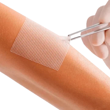 Jelonet Paraffin Gauze is a sterile, non-adherent dressing made from wide-meshed, specially woven gauze impregnated with white paraffin. Designed to prevent sticking to wounds, it offers soothing comfort, supports wound fluid drainage, and is compatible with external antiseptics or antibiotics. Ideal for burns, skin graft sites, open wounds, cuts, abrasions, leg ulcers, and pressure sores. - O-102611