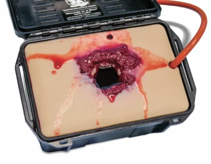 Gunshot Wound in a Box - Image 3