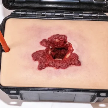 The Gunshot Wound in a Box® is a realistic, compact task trainer designed to teach wound packing for soft-tissue gunshot injuries. Made with durable, UV-resistant silicone and integrated blood tubing, it enables pressure-responsive bleeding when connected to a simulation system. - SÅR-PTT-B01