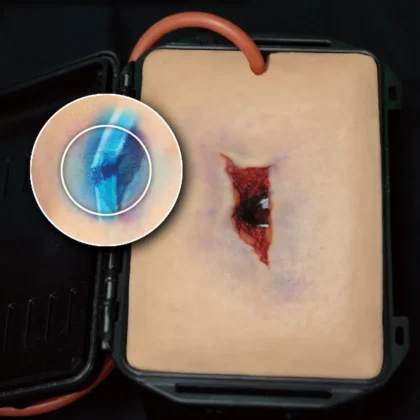 Shrapnel Wound in a Box - Image 3