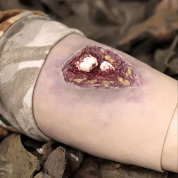 The Deluxe Moulage Kit by Techline Trauma is a comprehensive, portable trauma simulation set featuring ten high-fidelity wound models and an integrated bleeding system. Designed for real-world training, it supports diverse trauma scenarios for paramedics, emergency responders, and military personnel. - SÅR-WW3-000