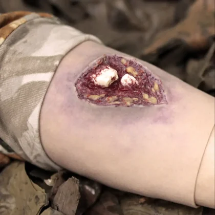 Deluxe Moulage Kit - Image 2