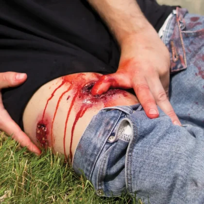 Deluxe Moulage Kit - Image 3