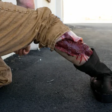 The Deluxe Moulage Kit by Techline Trauma is a comprehensive, portable trauma simulation set featuring ten high-fidelity wound models and an integrated bleeding system. Designed for real-world training, it supports diverse trauma scenarios for paramedics, emergency responders, and military personnel. - SÅR-WW3-000