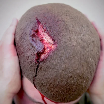 Deluxe Moulage Kit - Image 5