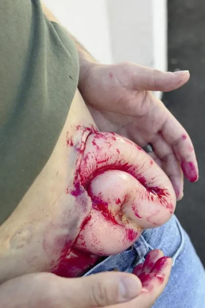 Deluxe Moulage Kit - Image 7