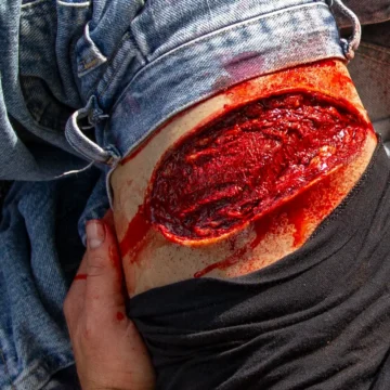 The Deluxe Moulage Kit by Techline Trauma is a comprehensive, portable trauma simulation set featuring ten high-fidelity wound models and an integrated bleeding system. Designed for real-world training, it supports diverse trauma scenarios for paramedics, emergency responders, and military personnel. - SÅR-WW3-000