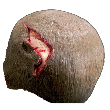 Open Wound - Scalp - Image 4