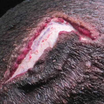 Open Wound - Scalp - Image 2