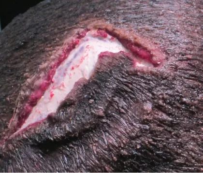 Open Wound - Scalp - Image 4