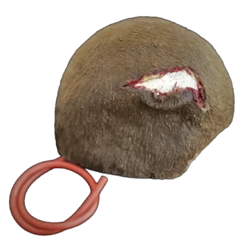 Open Wound - Scalp - Image 3
