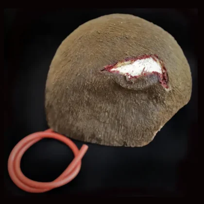 Open Wound - Scalp - Image 2