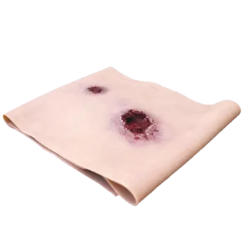 Gunshot wound (GSW) Leg