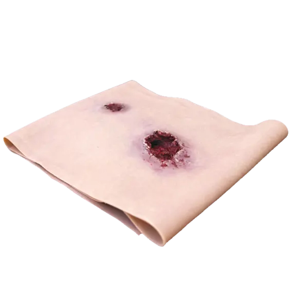 Gunshot wound (GSW) Leg 1 Gunshot wound (GSW) Leg