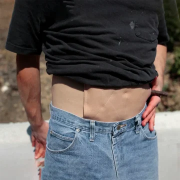 Wound Extender - Image 2