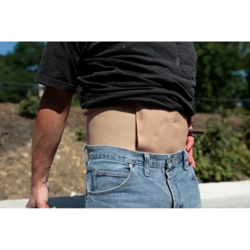 Wound Extender - Image 3