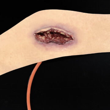 Neck Wound