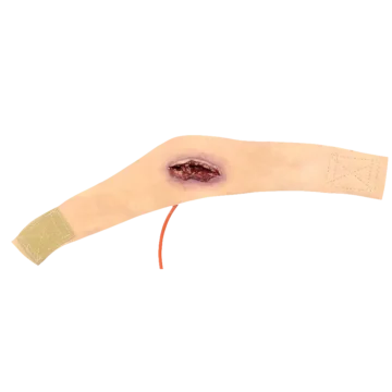 Neck Wound