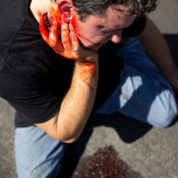 The Neck Wound is a wearable trauma simulator replicating a neck injury with exposed fat and muscle. Designed with integrated blood tubing and realistic materials, it wraps securely around an actor or manikin for effective bleeding control training. - SÅR-WW3-014