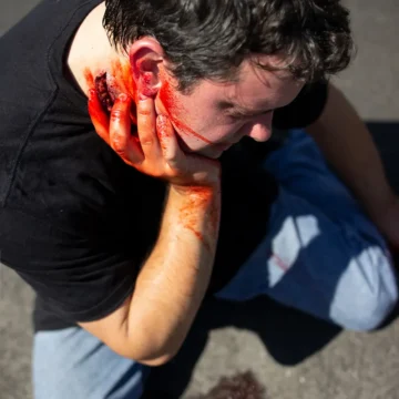 Neck Wound - Image 4
