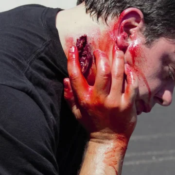Neck Wound - Image 3
