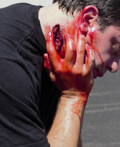 Neck Wound - Image 4