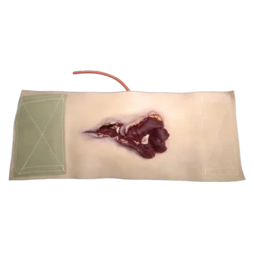 Gunshot Wound Bicep - Image 2