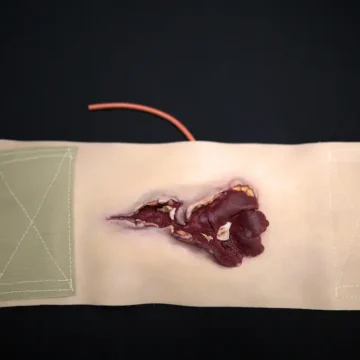 The Gunshot Wound Bicep is a wearable, high-fidelity trauma simulator depicting a high-velocity gunshot injury with exposed fat, muscle, bone, and tendons. Designed for bleeding control training, it includes a blood supply system and secures easily to actors or manikins. - SÅR-WW3-908