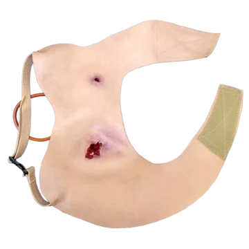 Gunshot Wound Clavicle (Right)
