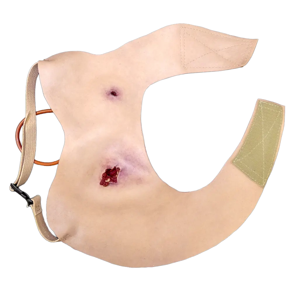 Gunshot Wound Clavicle (Right) 1 Gunshot Wound Clavicle (Right)