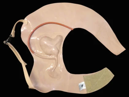 Gunshot Wound Clavicle (Right) - Image 2