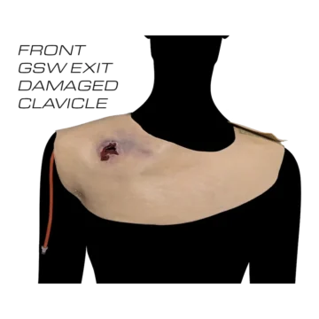 Gunshot Wound Clavicle (Right) 9 Gunshot Wound Clavicle (Right) - Image 3