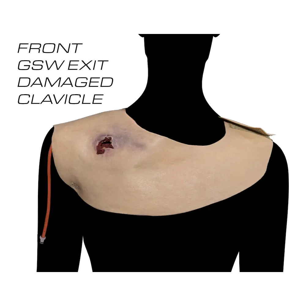 Gunshot Wound Clavicle (Right) 3 Gunshot Wound Clavicle (Right) - Image 3