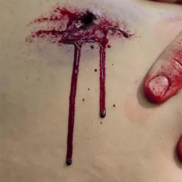 The Gunshot Wound Clavicle (Right) is a wearable simulation of a through-and-through gunshot injury, exposing fat, muscle, bone, and tendons. Featuring packable entry and exit wounds, it includes a bleeding system and provides realistic crepitus sensation for enhanced training. - SÅR-WW3-909