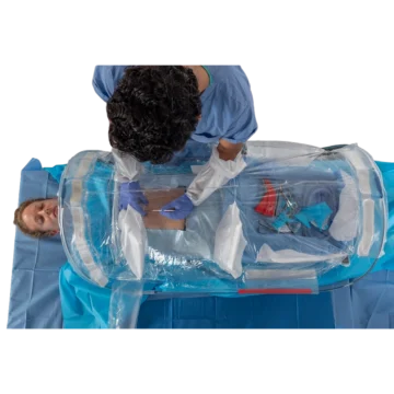 The SurgiBubble is a sterile, single-use inflatable surgical enclosure designed to create a controlled barrier around the surgical site. It helps isolate the procedure area from external contamination while supporting safe access for surgical intervention. - AC-28